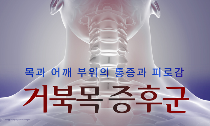 거북목, 목디스크로 악화되기 전에 예방 방법 알아보기