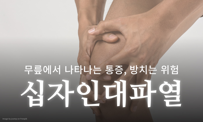 십자인대 파열 치료는 수술뿐일까요? 십자인대 재건술